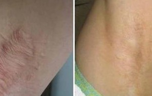 �����ᴫȾ��